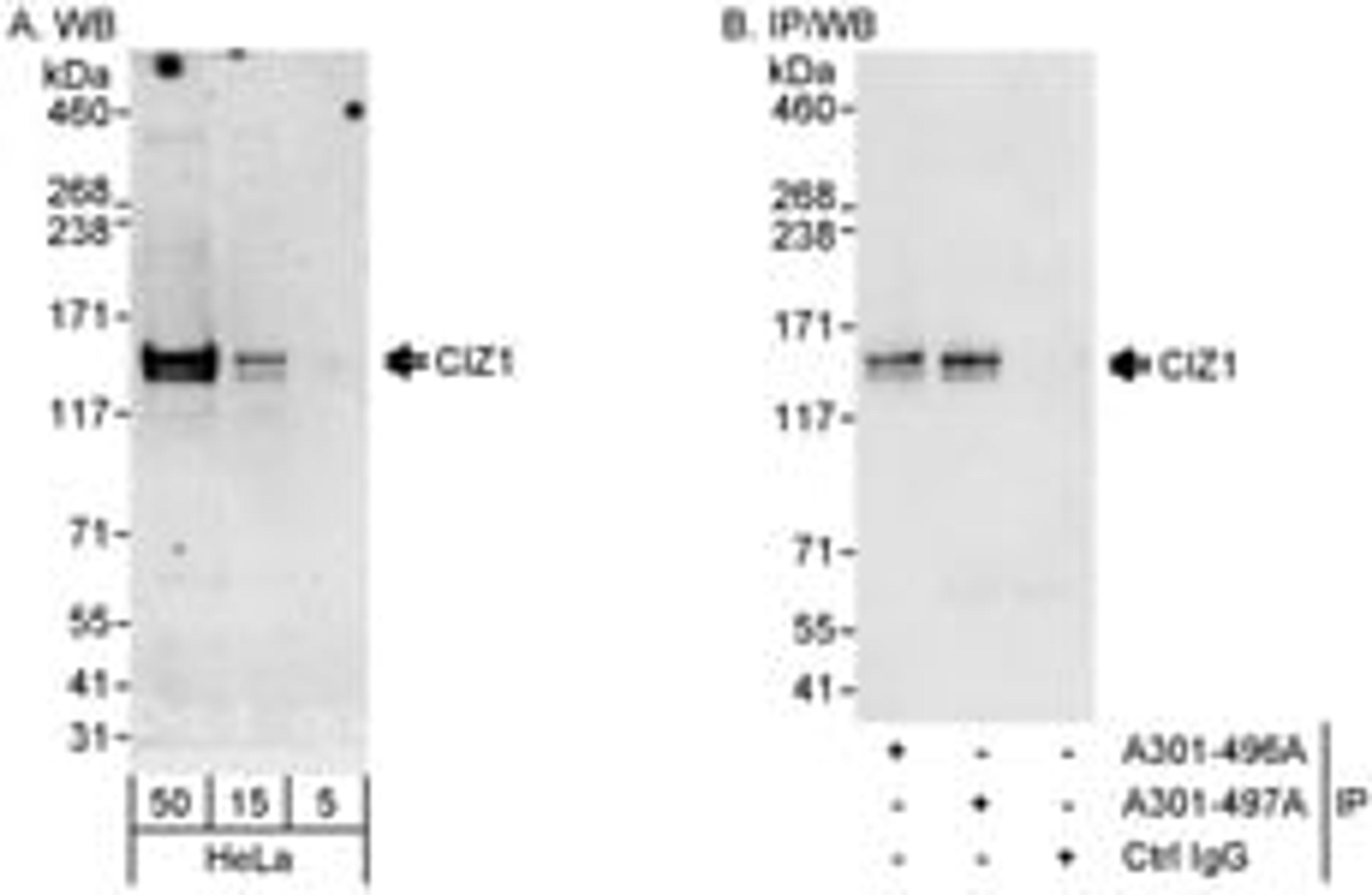 Detection of human CIZ1 by western blot and immunoprecipitation.