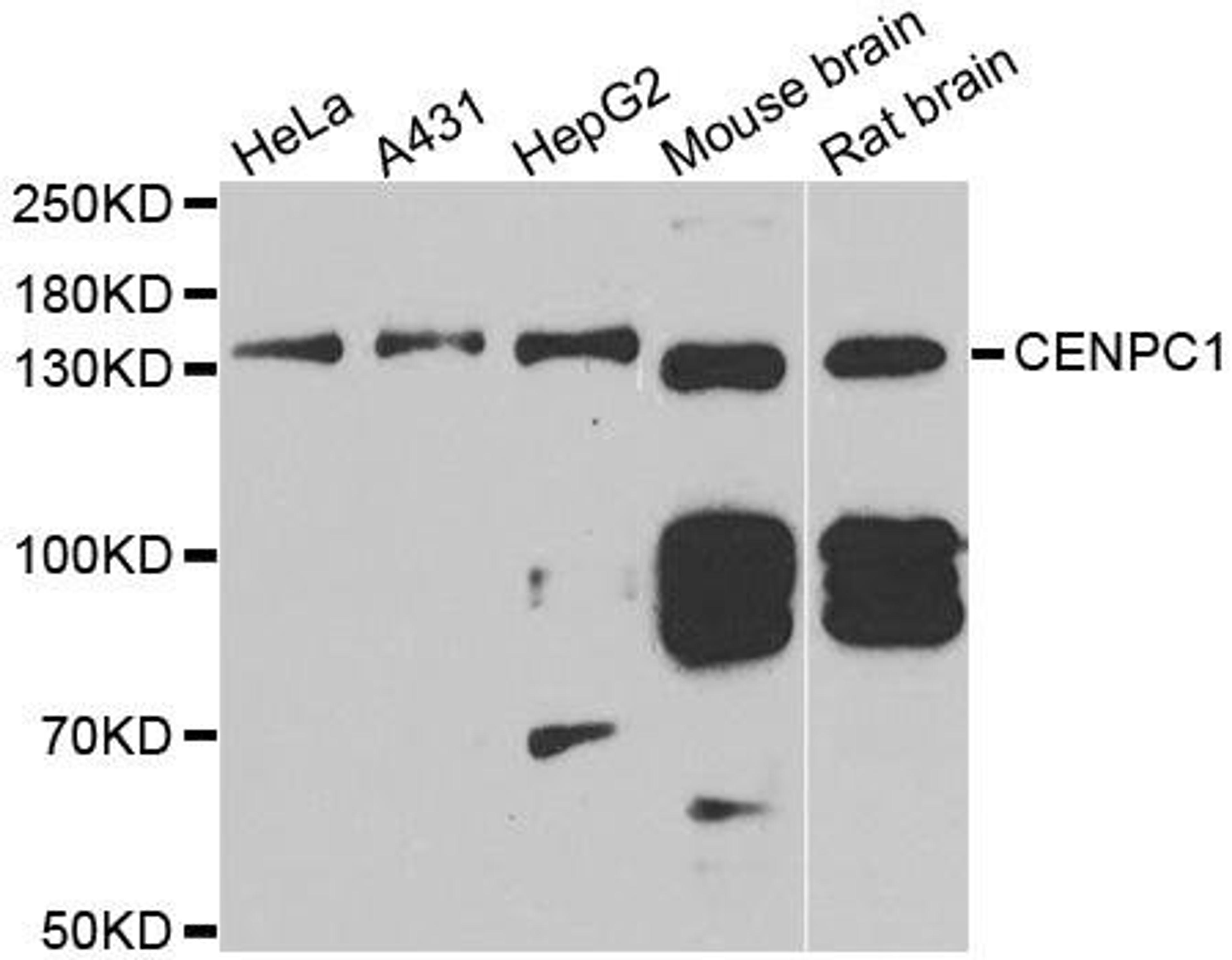 Western blot analysis of extracts of various cell lines using CENPC1 antibody