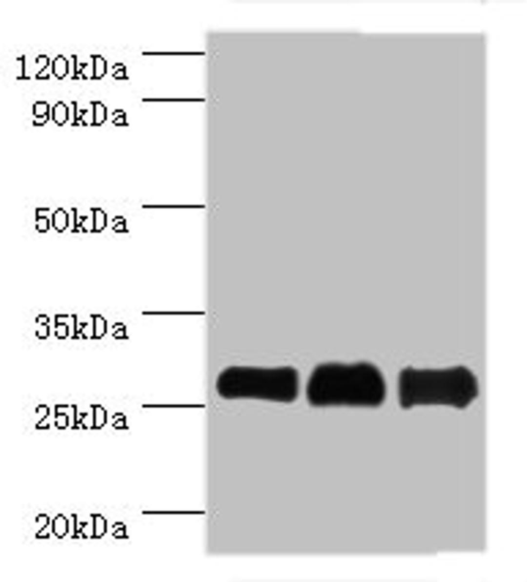 Western blot. All lanes: B-cell lymphoma/leukemia 10 antibody at 9ug/ml. Lane 1: Mouse gonad tissue. Lane 2: MCF-7 whole cell lysate. Lane 3: NIH/3T3 whole cell lysate. Secondary. Goat polyclonal to rabbit IgG at 1/10000 dilution. Predicted band size: 26 kDa. Observed band size: 26 kDa.