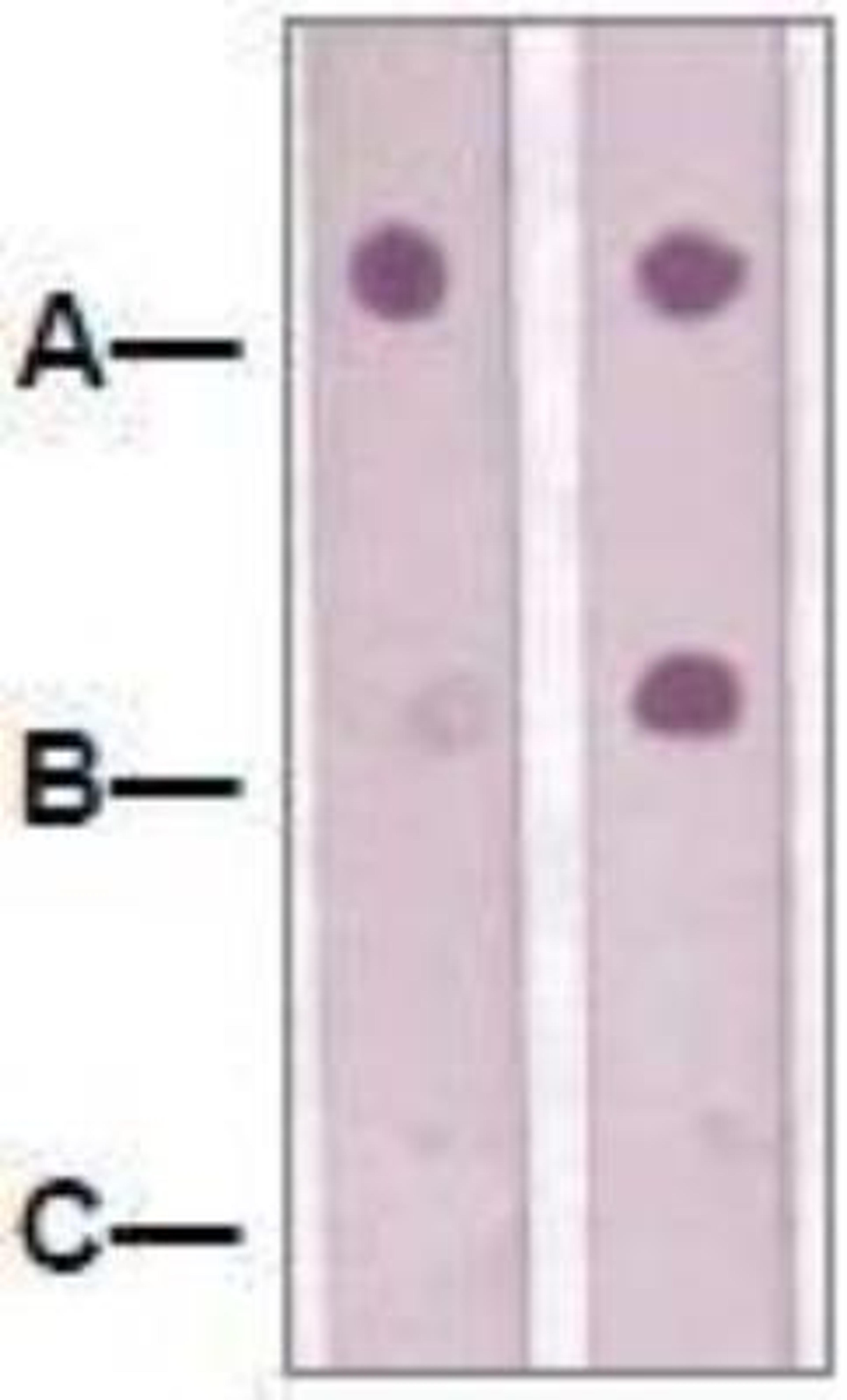 Dot Blot: JNK1 [p Thr183, p Tyr185] Antibody [NBP1-72242] - 1 mg peptide was blot onto NC membrane:   A: JNK1 [p Thr183, p Tyr185] / B: JNK (Non phosphospeicfic) / C: Non-related Phosphopeptide were blotted at a 1:2000 dilution by: 1: Rabbit anti-JNK1 [p Thr183, p Tyr185]