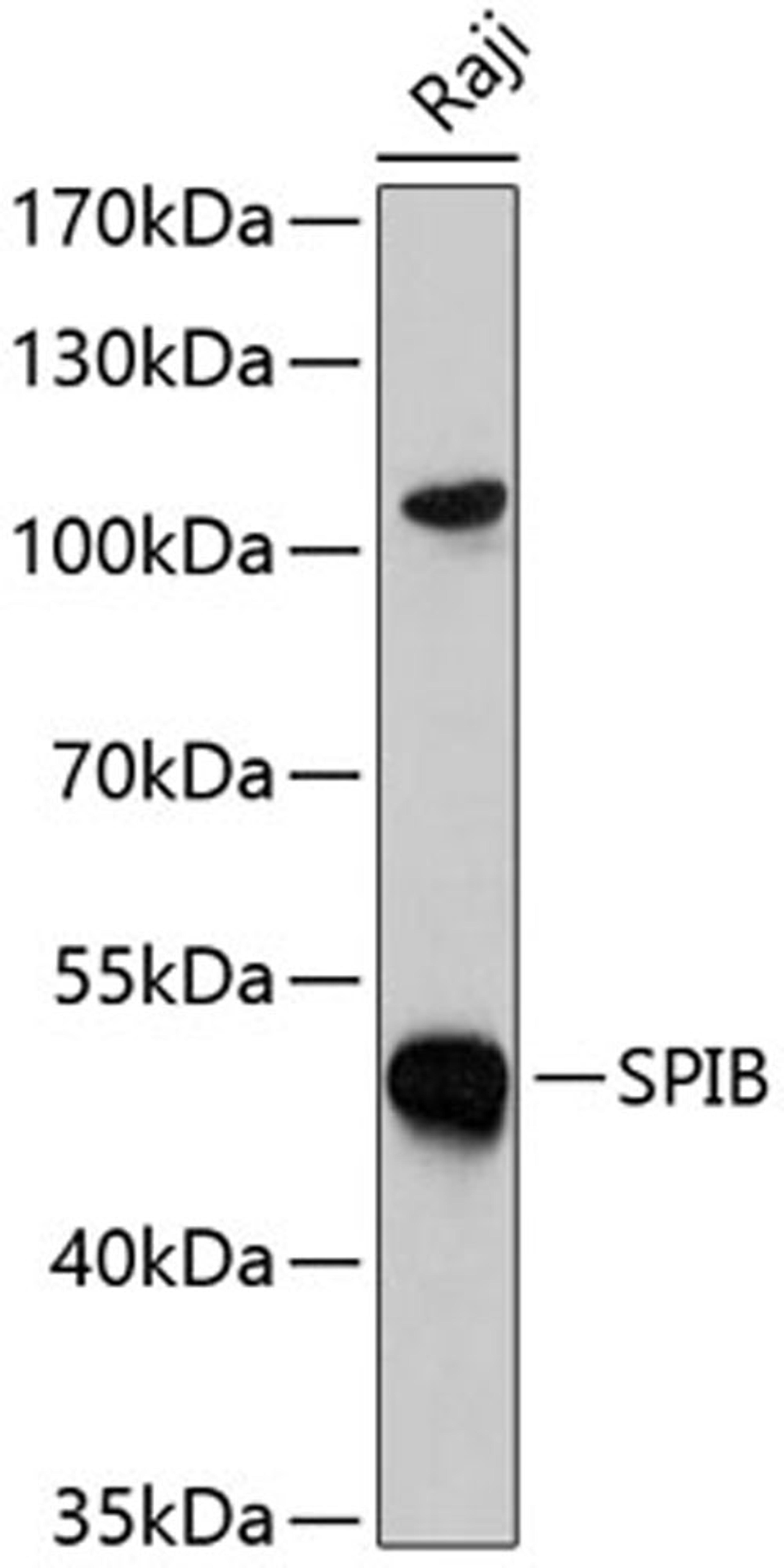 Western blot - SPIB antibody (A7451)