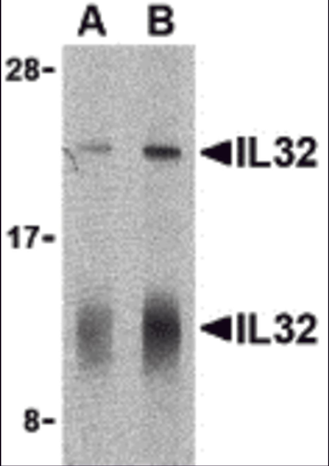 Western blot analysis of IL-32 in human spleen lysate with IL-32 antibody at (A) 5 and (B) 10 &#956;g/mL shows two isoforms of IL-32.