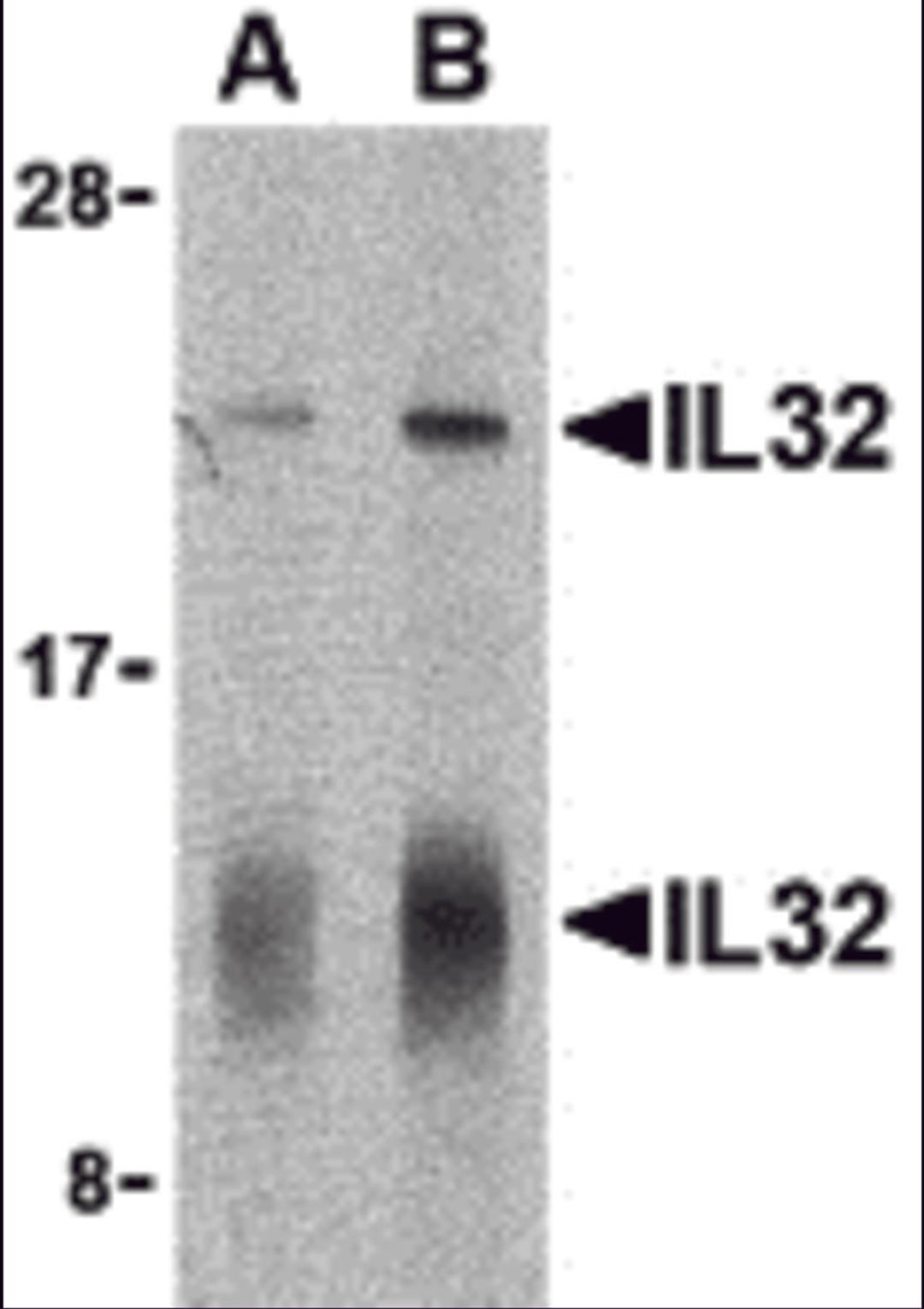Western blot analysis of IL-32 in human spleen lysate with IL-32 antibody at (A) 5 and (B) 10 μg/mL shows two isoforms of IL-32.