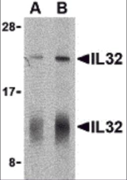 Western blot analysis of IL-32 in human spleen lysate with IL-32 antibody at (A) 5 and (B) 10 μg/mL shows two isoforms of IL-32.