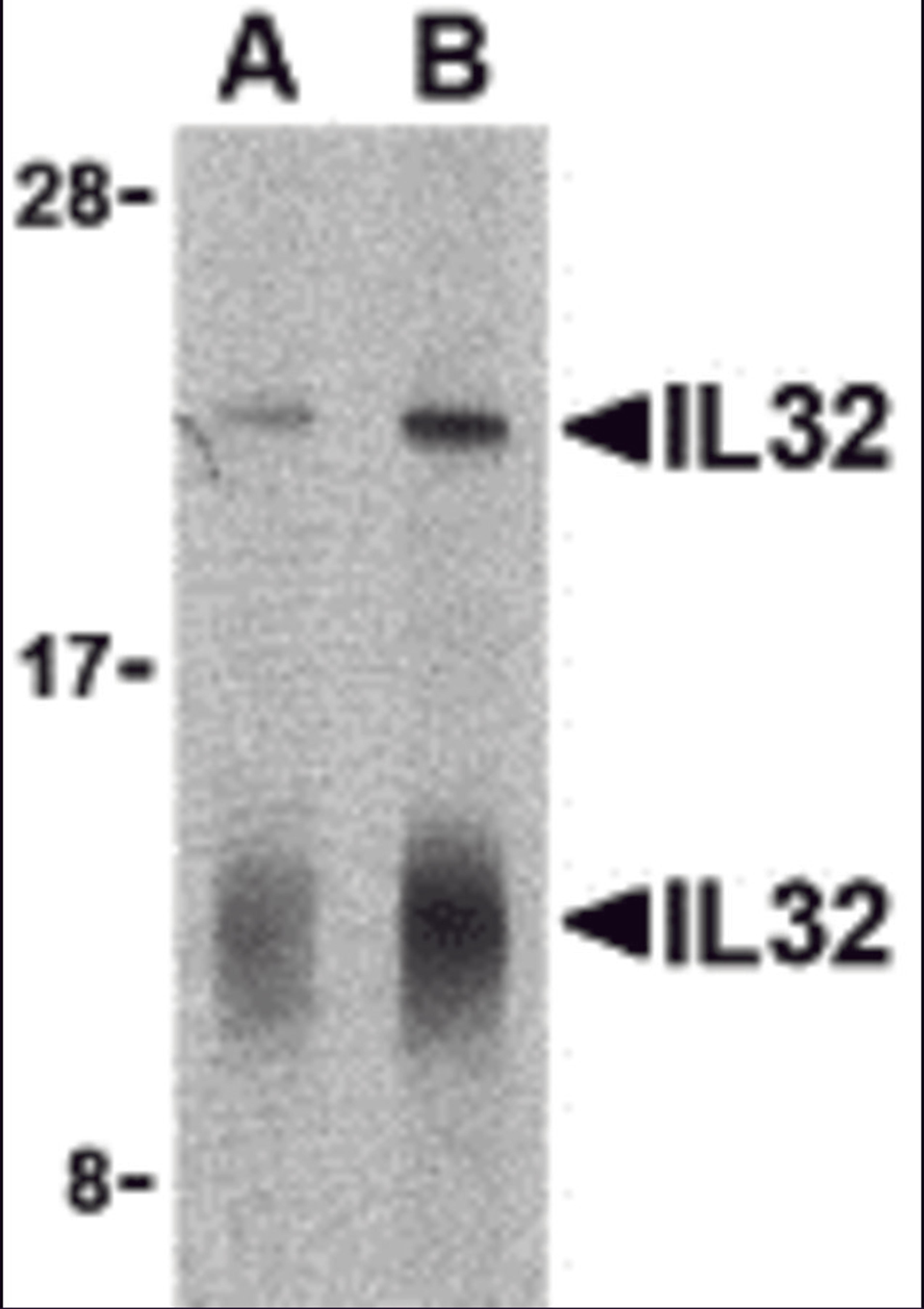 Western blot analysis of IL-32 in human spleen lysate with IL-32 antibody at (A) 5 and (B) 10 μg/mL shows two isoforms of IL-32.