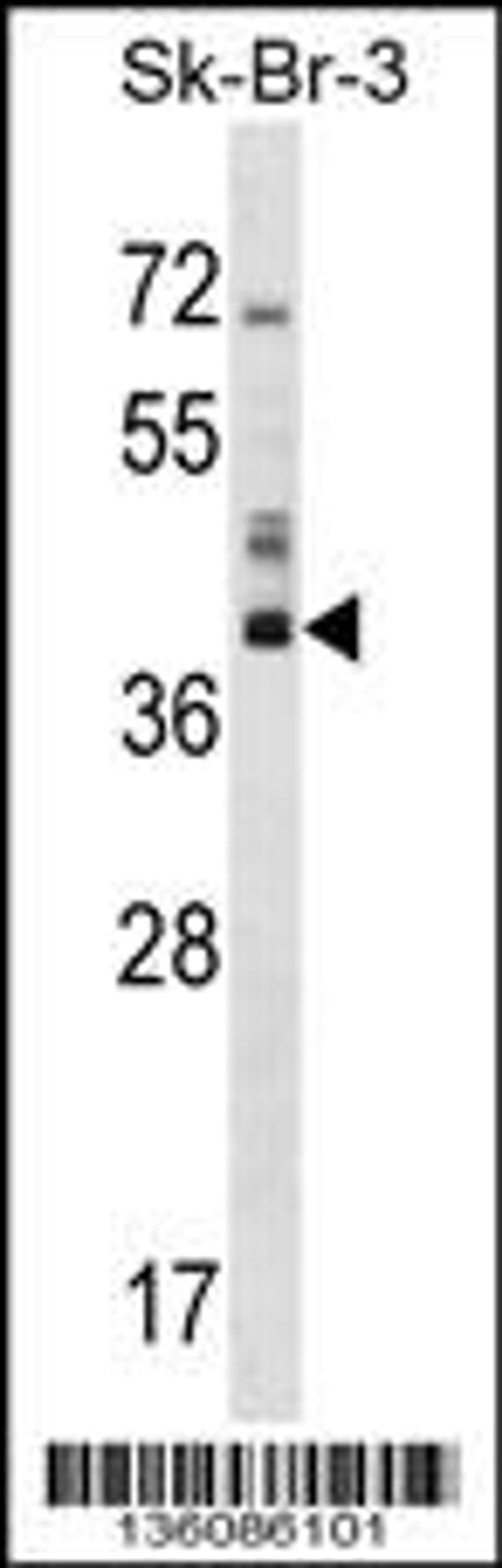 Western blot analysis in SK-BR-3 cell line lysates (35ug/lane).