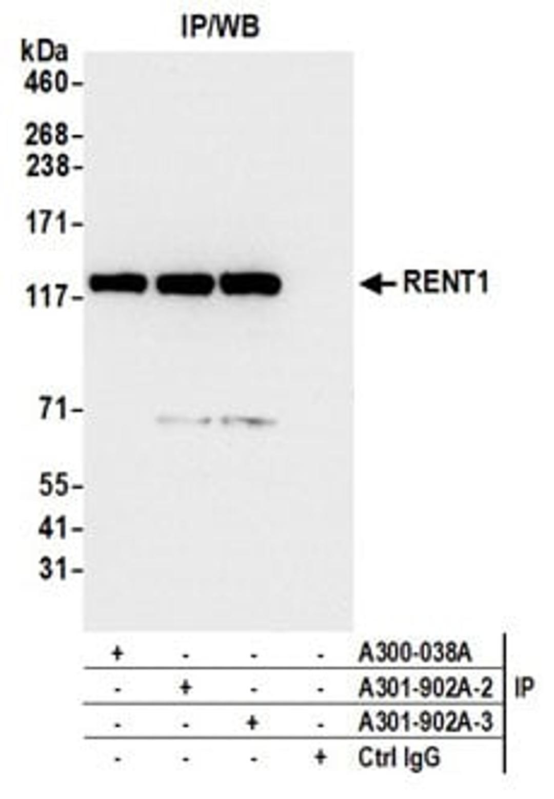 Detection of human RENT1 by western blot of immunoprecipitates.