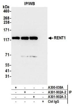 Detection of human RENT1 by western blot of immunoprecipitates.