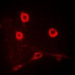 Immunofluorescent analysis of MCF7 cells using IL12RB1 antibody