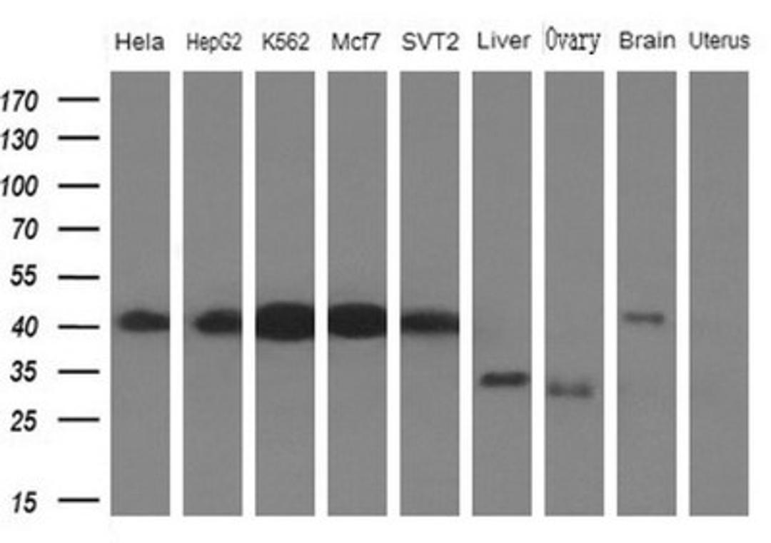 Western Blot: PCBP1 Antibody (3D12) [NBP2-46336] - Analysis of extracts (10ug) from 5 different cell lines and 4 human tissue by using PCBP1 monoclonal antibody (1: Hela; 2: HepG2; 3: K562; 4: Mcf7; 5: SVT2; 6: Liver; 7: Testis; 8: Brain; 9: Uterus)at 1:200 dilution.