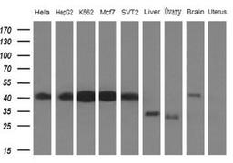 Western Blot: PCBP1 Antibody (3D12) [NBP2-46336] - Analysis of extracts (10ug) from 5 different cell lines and 4 human tissue by using PCBP1 monoclonal antibody (1: Hela; 2: HepG2; 3: K562; 4: Mcf7; 5: SVT2; 6: Liver; 7: Testis; 8: Brain; 9: Uterus)at 1:200 dilution.