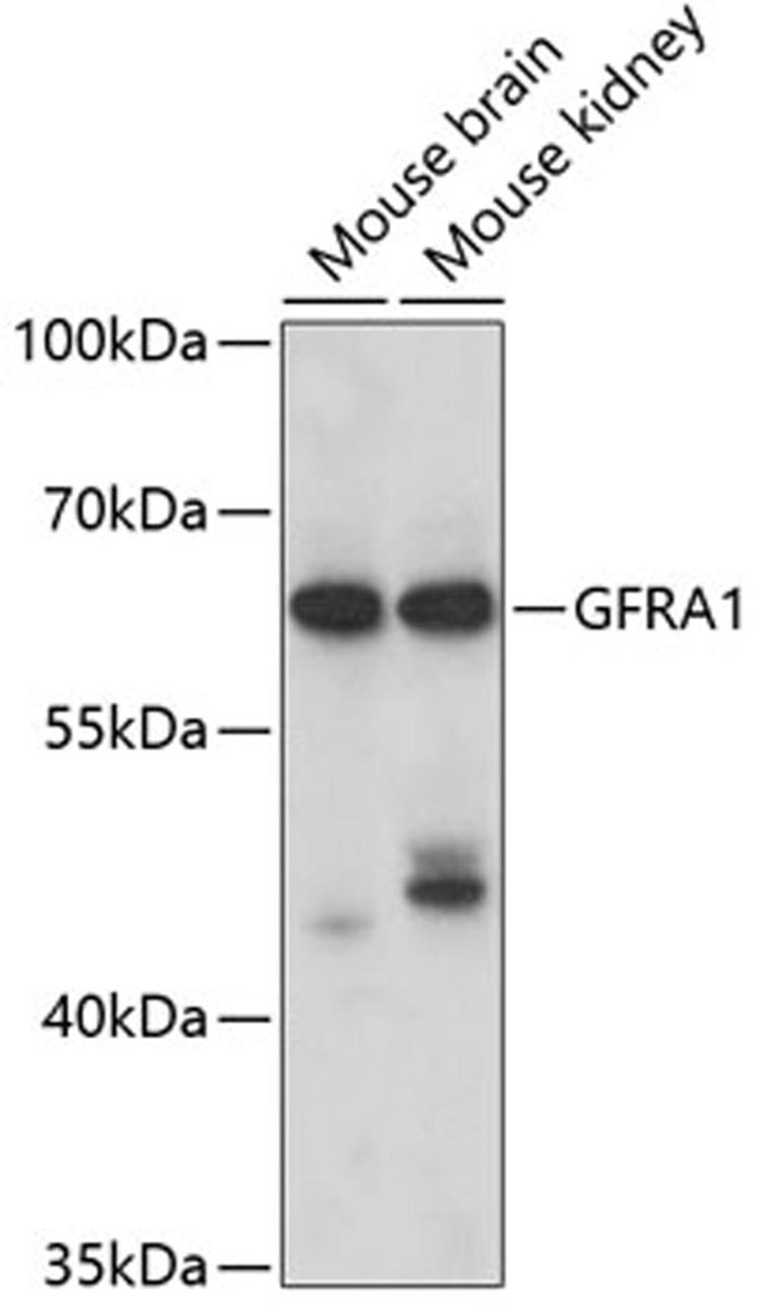 Western blot - GFRA1 antibody (A5373)