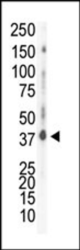 Western blot analysis of anti-CK1d C-term Pab in HeLa cell lysate