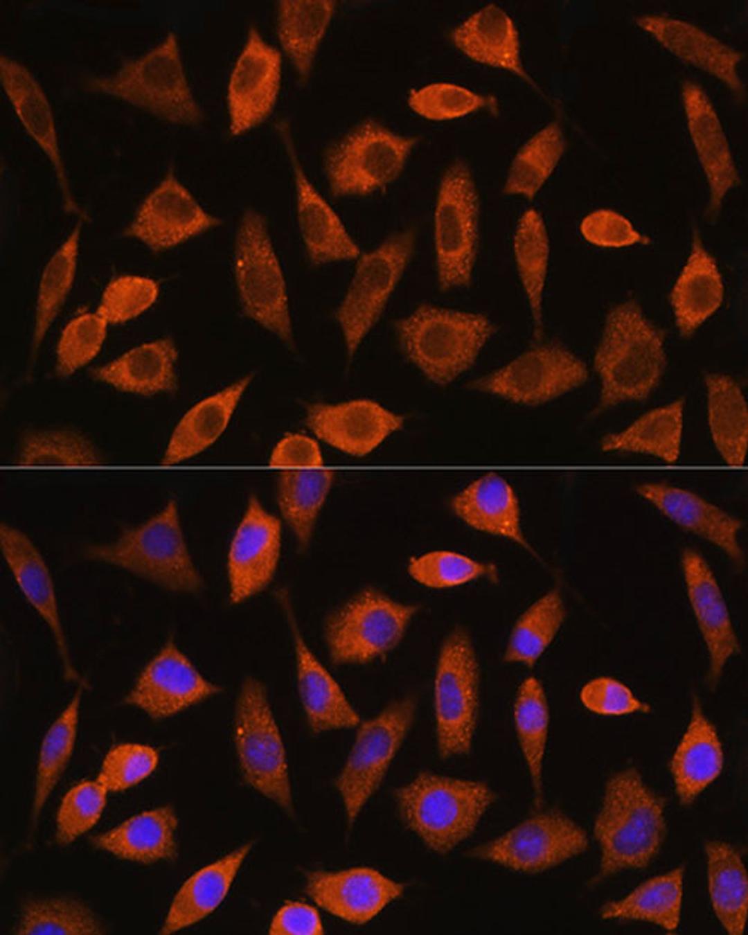 Immunofluorescence - EIF2B4 Rabbit pAb (A18203)