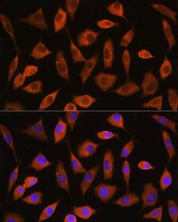 Immunofluorescence - EIF2B4 Rabbit pAb (A18203)