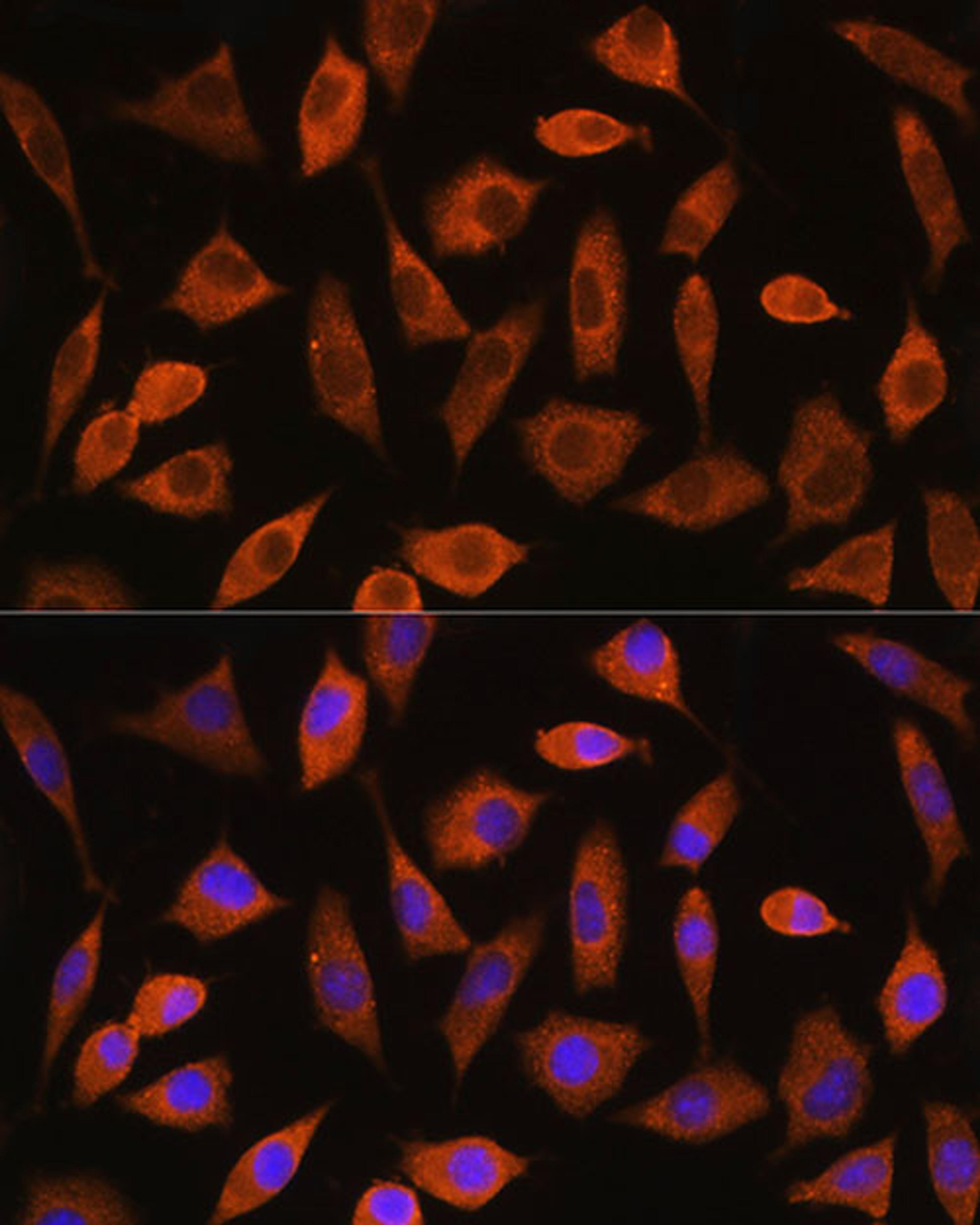 Immunofluorescence - EIF2B4 Rabbit pAb (A18203)