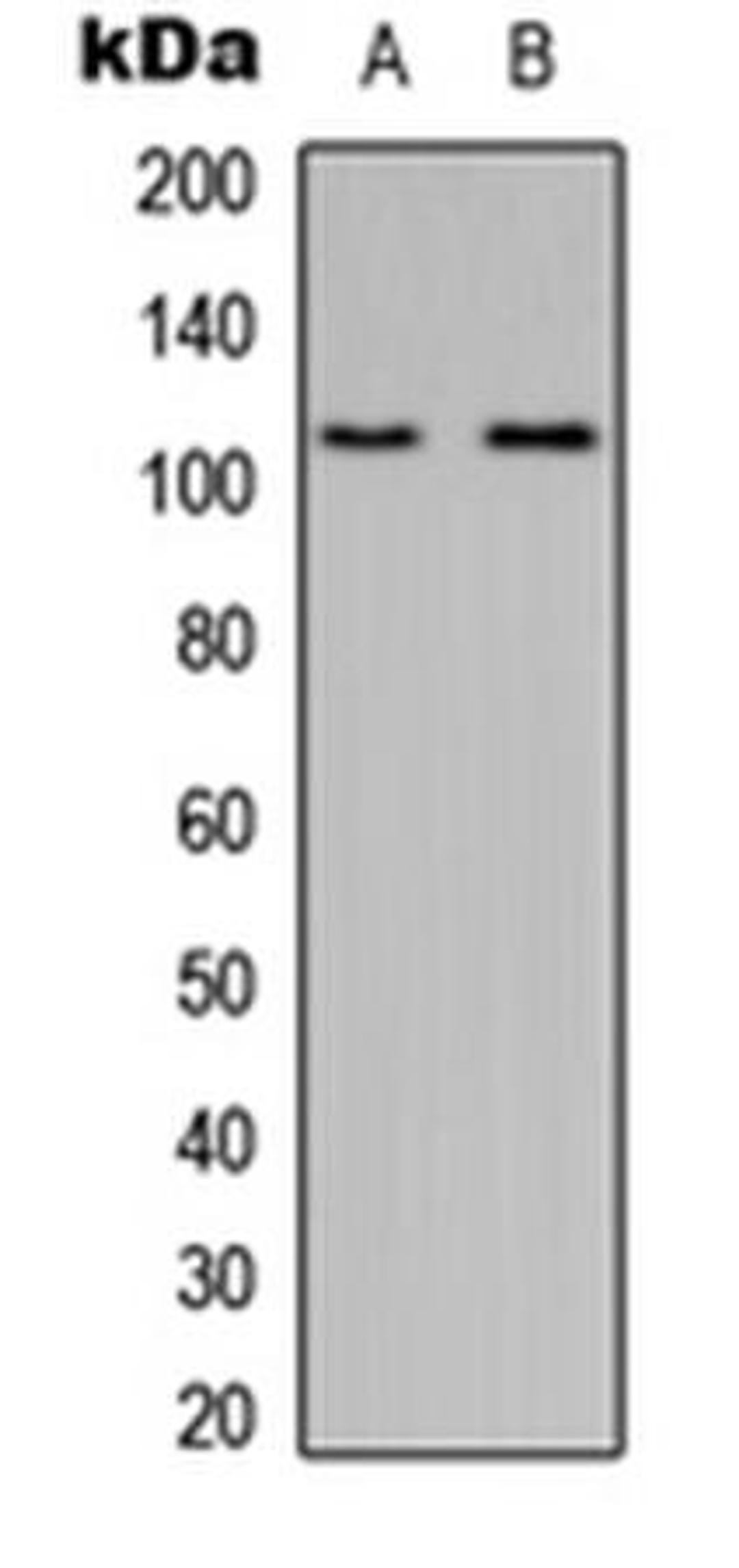 Western blot analysis of HeLa (Lane1), Raw264.7 (Lane2) whole cell using MYO1D antibody