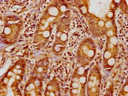 IHC image of CSB-PA010377OA17nphHU diluted at 1:8 and staining in paraffin-embedded human small intestine tissue performed on a Leica BondTM system. After dewaxing and hydration, antigen retrieval was mediated by high pressure in a citrate buffer (pH 6.0). Section was blocked with 10% normal goat serum 30min at RT. Then primary antibody (1% BSA) was incubated at 4°C overnight. The primary is detected by a biotinylated secondary antibody and visualized using an HRP conjugated SP system.