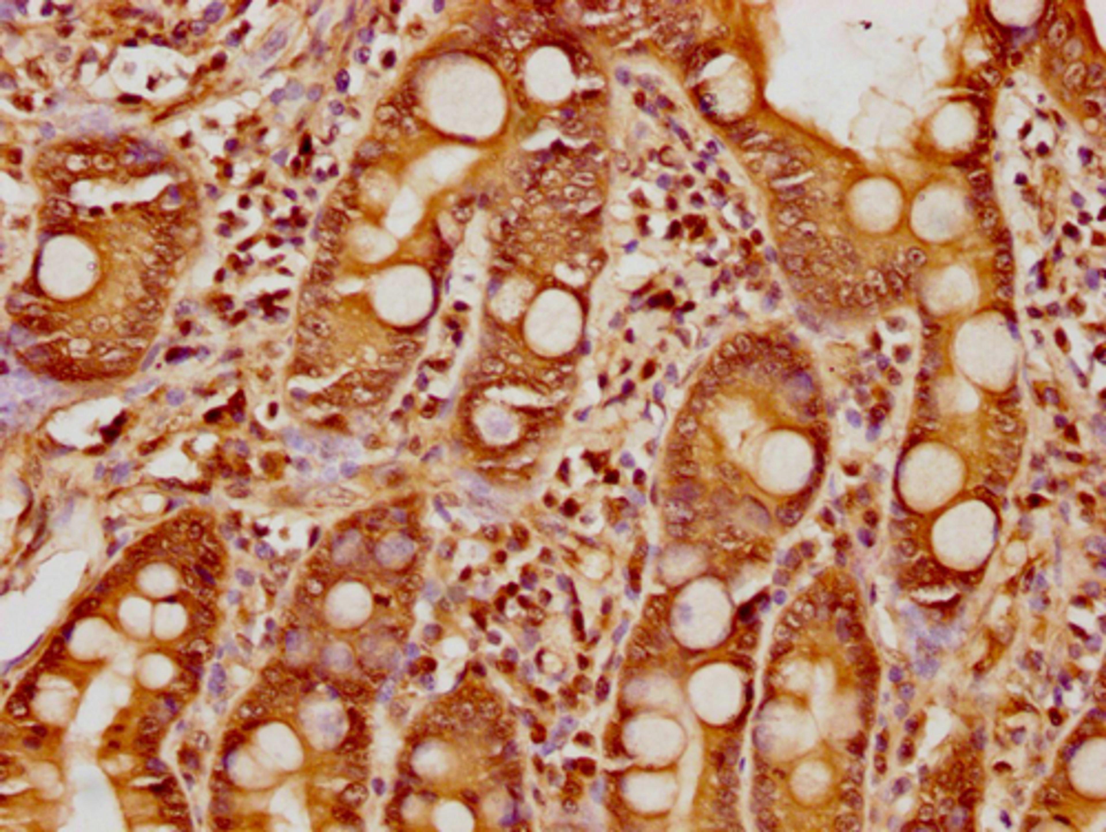 IHC image of CSB-PA010377OA17nphHU diluted at 1:8 and staining in paraffin-embedded human small intestine tissue performed on a Leica BondTM system. After dewaxing and hydration, antigen retrieval was mediated by high pressure in a citrate buffer (pH 6.0). Section was blocked with 10% normal goat serum 30min at RT. Then primary antibody (1% BSA) was incubated at 4°C overnight. The primary is detected by a biotinylated secondary antibody and visualized using an HRP conjugated SP system.