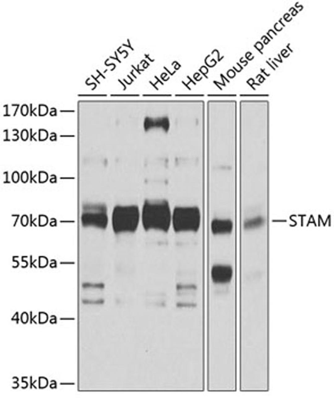 Western blot - STAM antibody (A4198)