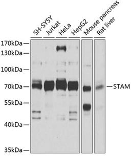 Western blot - STAM antibody (A4198)