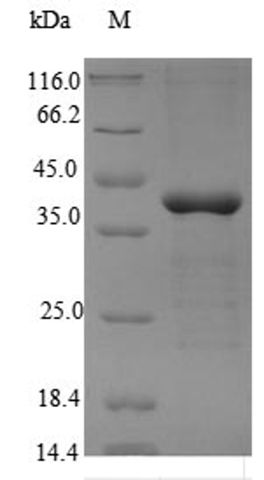 (Tris-Glycine gel) Discontinuous SDS-PAGE (reduced) with 5% enrichment gel and 15% separation gel.