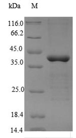 (Tris-Glycine gel) Discontinuous SDS-PAGE (reduced) with 5% enrichment gel and 15% separation gel.