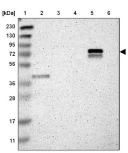 Western Blot: ACSF3 Antibody [NBP1-86119] - Lane 1: Marker [kDa] 230, 130, 95, 72, 56, 36, 28, 17, 11<br/>Lane 2: Human cell line RT-4<br/>Lane 3: Human cell line U-251MG sp<br/>Lane 4: Human plasma (IgG/HSA depleted)<br/>Lane 5: Human liver tissue<br/>Lane 6: Human tonsil tissue