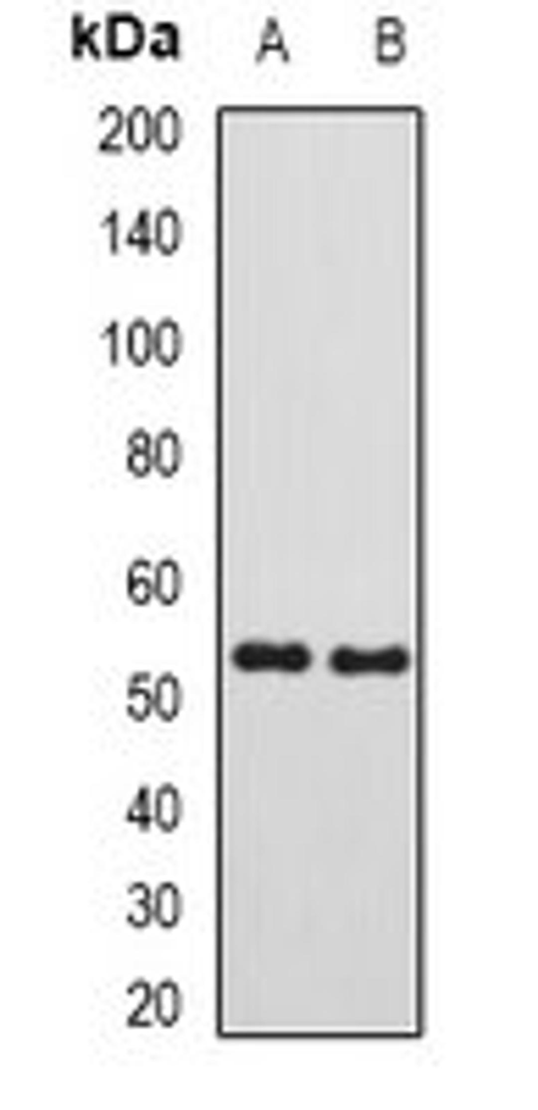 Western blot analysis of mouse testis (Lane1), rat kidney (Lane2) whole cell lysates using SUFU antibody