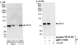 Western Blot: RRN3 Antibody [NBP1-71822] - Whole cell lysate from HeLa (5, 15 and 50 mcg for WB; 1 mg for IP, 20% of IP loaded) and Jurkat (J; 50 mcg) cells. Affinity purified rabbit anti-TIF-IA antibody used for WB at 0.1 mcg/ml (A) and 1 mcg/ml (B) and used for IP at 6 mcg/mg lysate.  TIF-IA was also immunoprecipitated by another rabbit anti-TIF-IA antibody  which recognizes an upstream epitope.