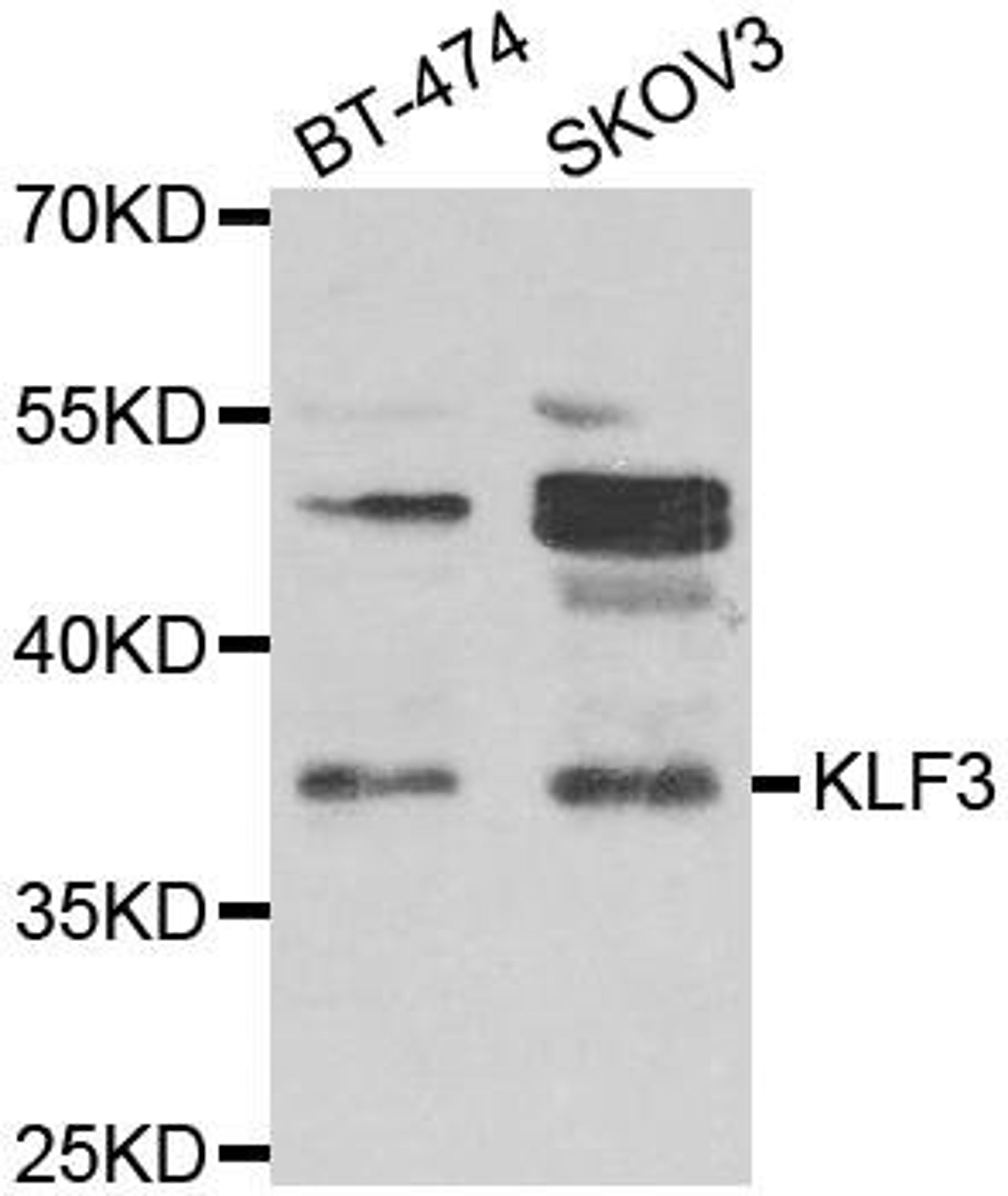 Western blot analysis of extracts of various cell lines using KLF3 antibody