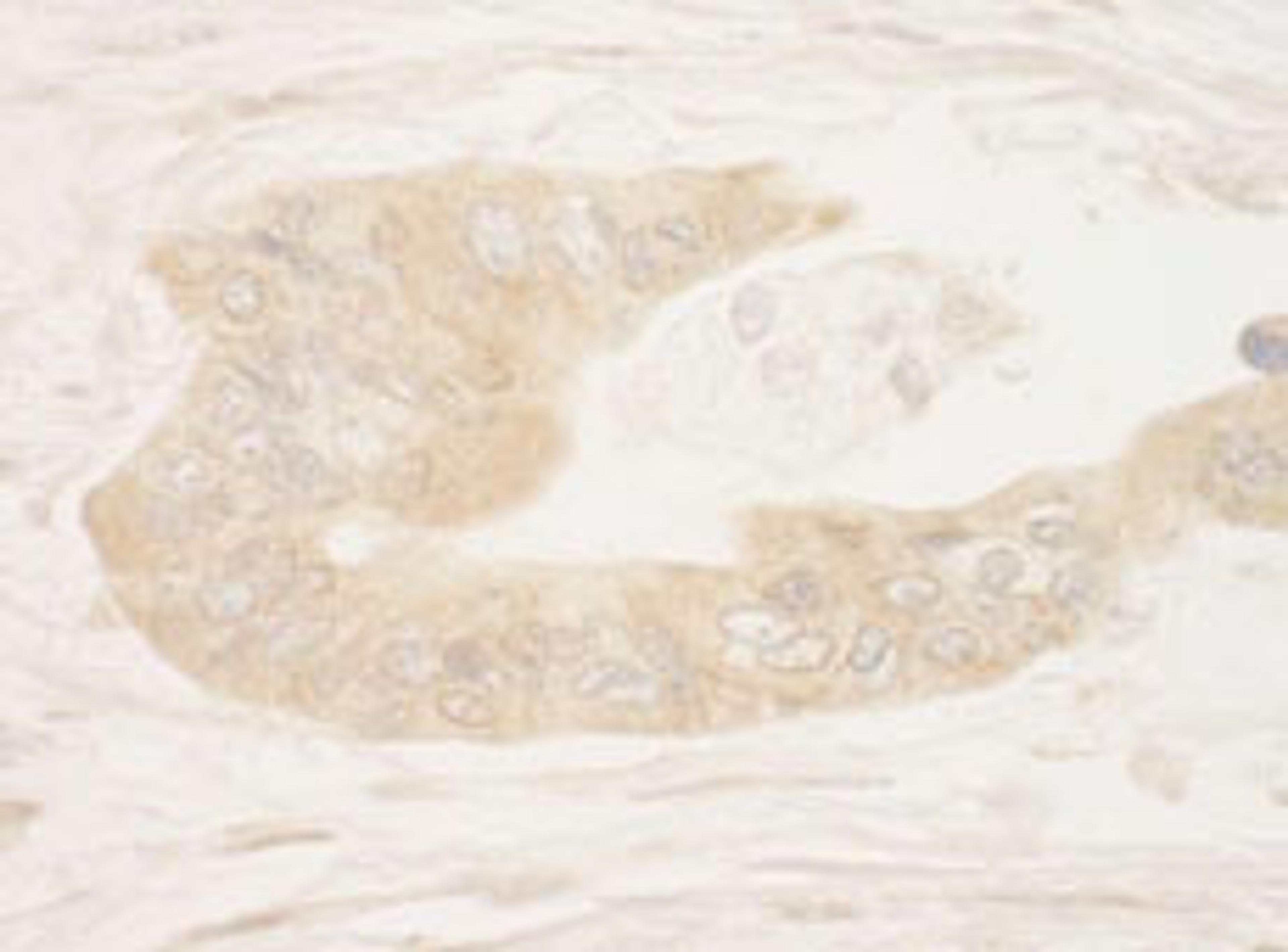 Detection of human RSK1 by immunohistochemistry.