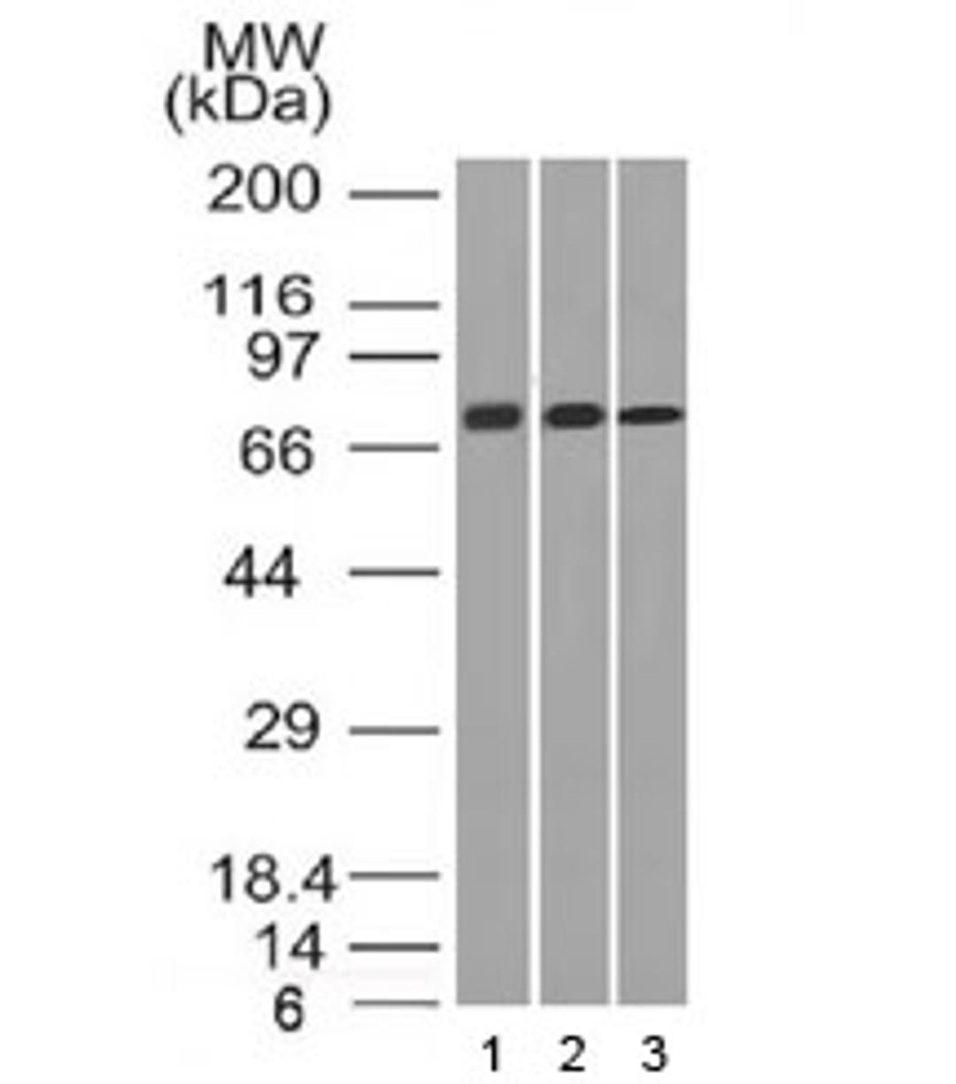 Western blot testing of human 1) HeLa, 2) A431 and 3) HL60 cell lysate with CD105 antibody (clone ENG/1326).  Observed molecular weight: 70/90 kDa (monomer, unmodified/glycosylated); 140-180 kDa (dimer, unmodified/glycosylated).