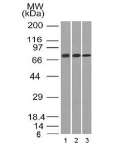 Western blot testing of human 1) HeLa, 2) A431 and 3) HL60 cell lysate with CD105 antibody (clone ENG/1326).  Observed molecular weight: 70/90 kDa (monomer, unmodified/glycosylated); 140-180 kDa (dimer, unmodified/glycosylated).