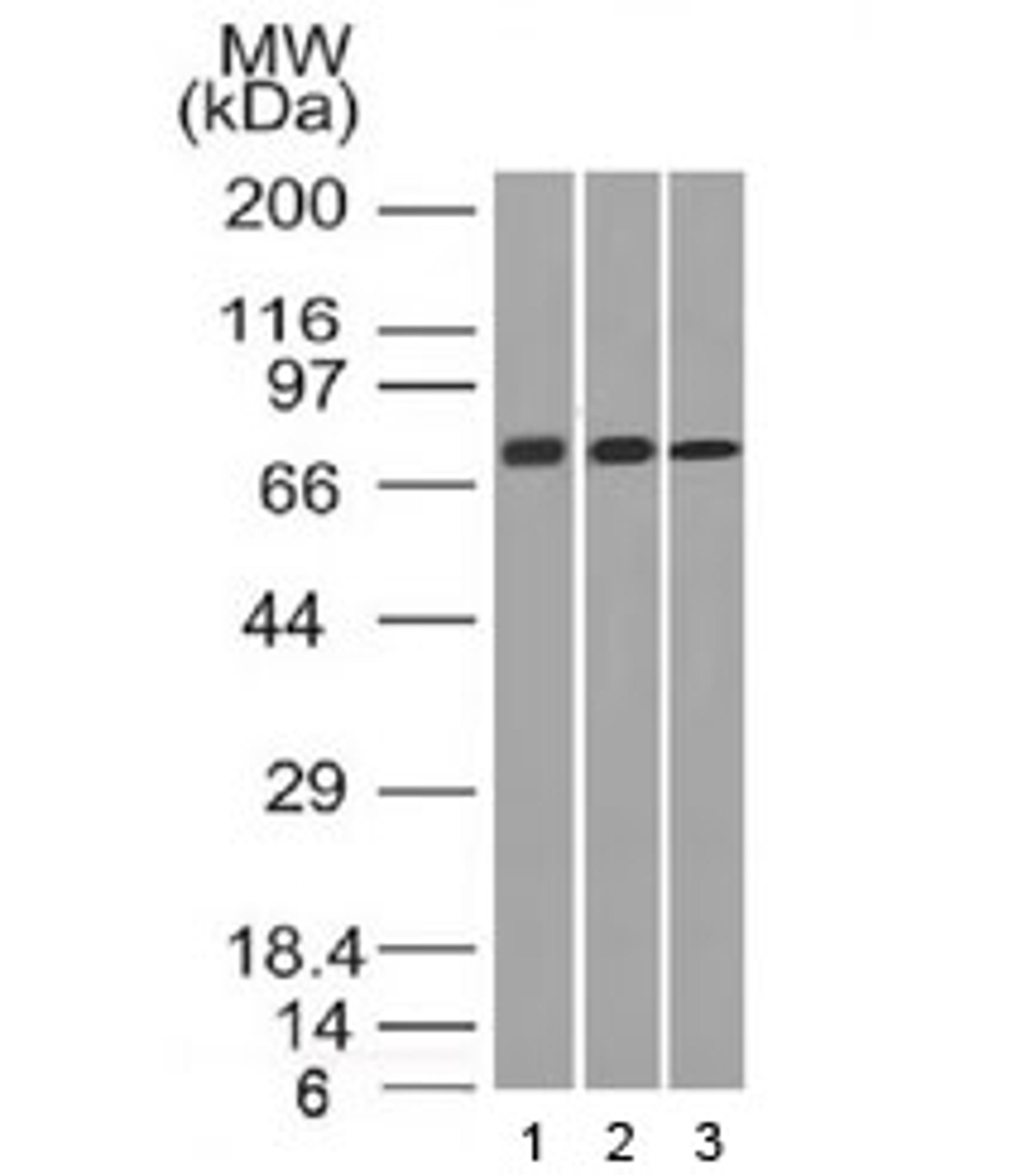 Western blot testing of human 1) HeLa, 2) A431 and 3) HL60 cell lysate with CD105 antibody (clone ENG/1326). Observed molecular weight: 70/90 kDa (monomer, unmodified/glycosylated); 140-180 kDa (dimer, unmodified/glycosylated).
