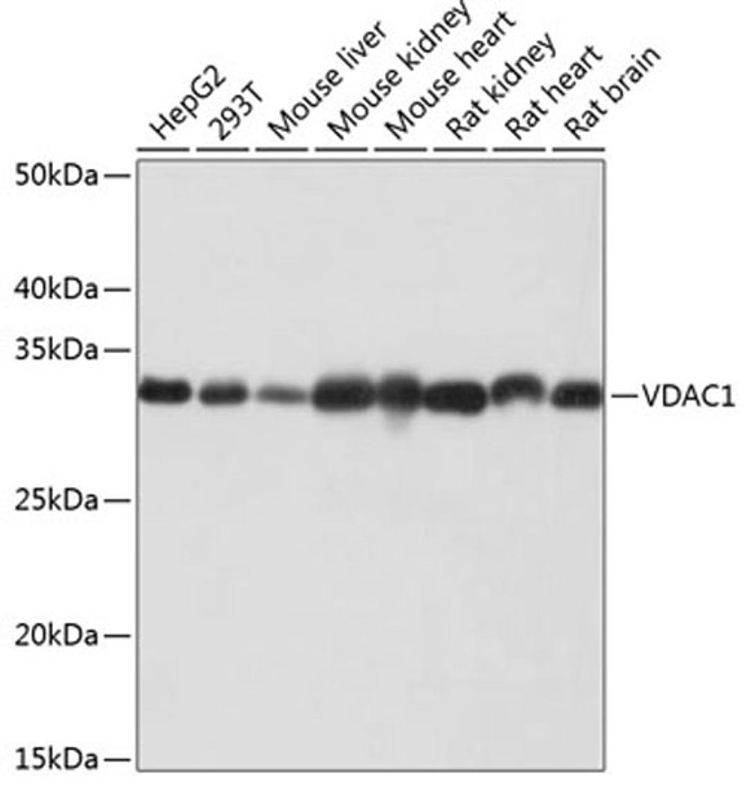 Western blot - VDAC1 antibody (A19707)