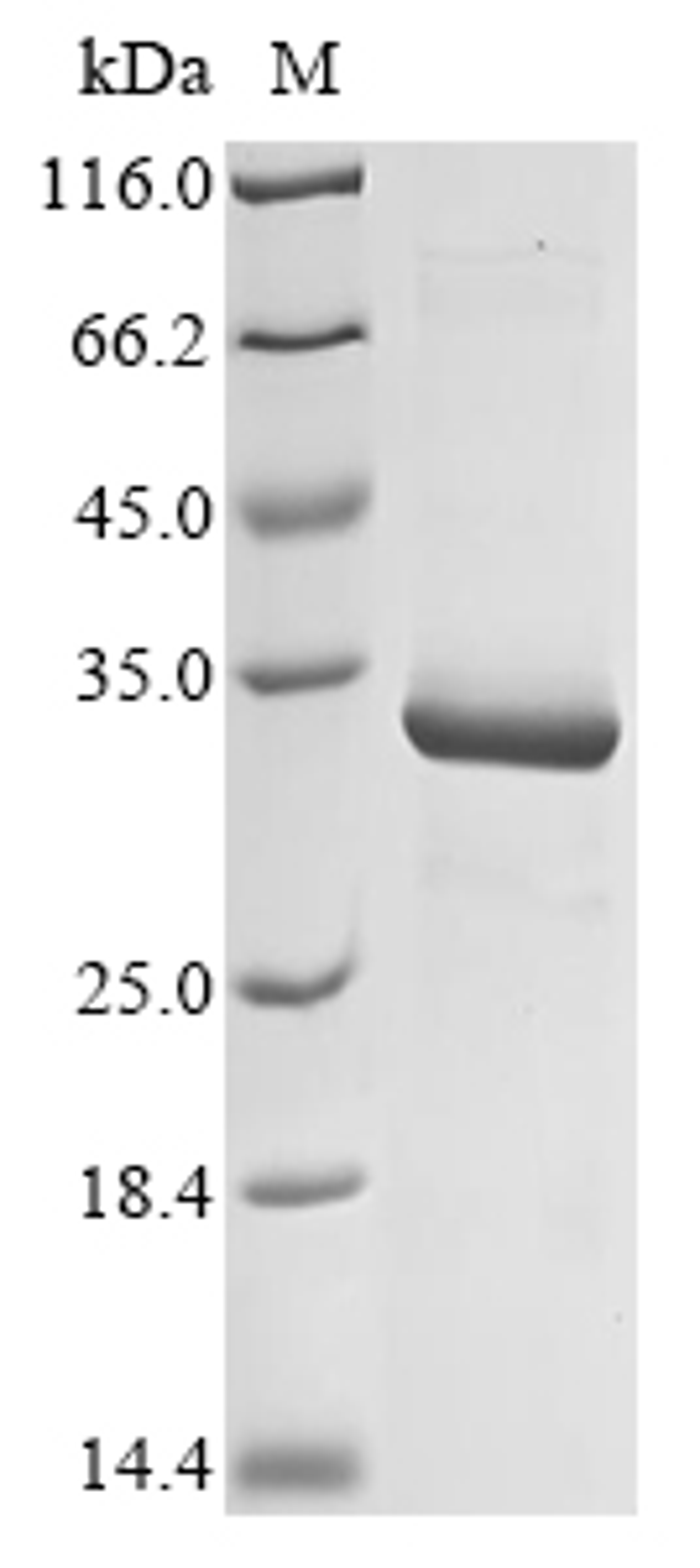 (Tris-Glycine gel) Discontinuous SDS-PAGE (reduced) with 5% enrichment gel and 15% separation gel.