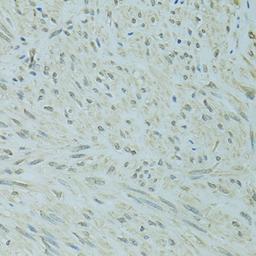 Immunohistochemistry  - XBP1 antibody (A14860)