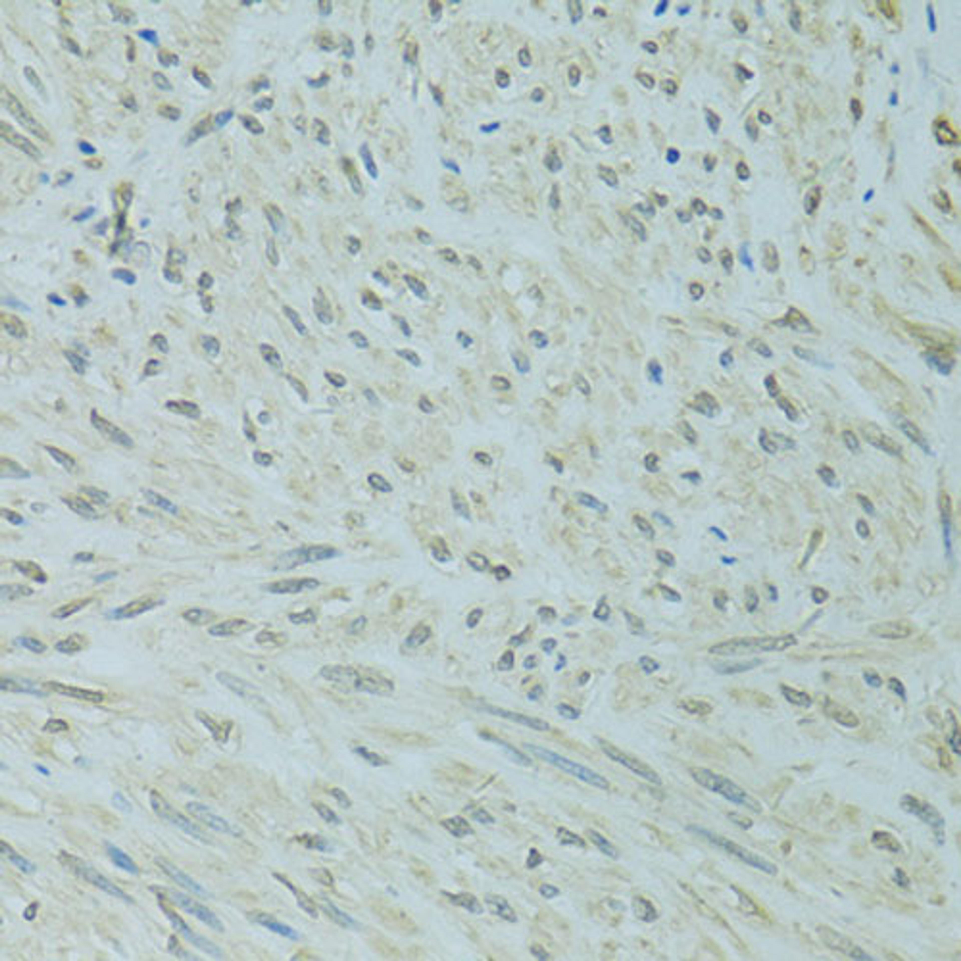 Immunohistochemistry  - XBP1 antibody (A14860)