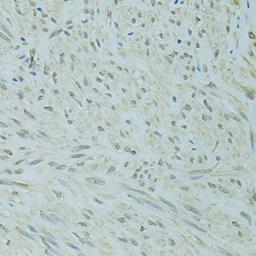 Immunohistochemistry - XBP1 antibody (A14860)