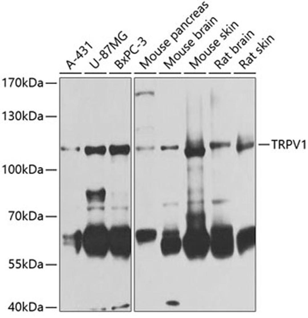 Western blot - TRPV1 antibody (A8564)