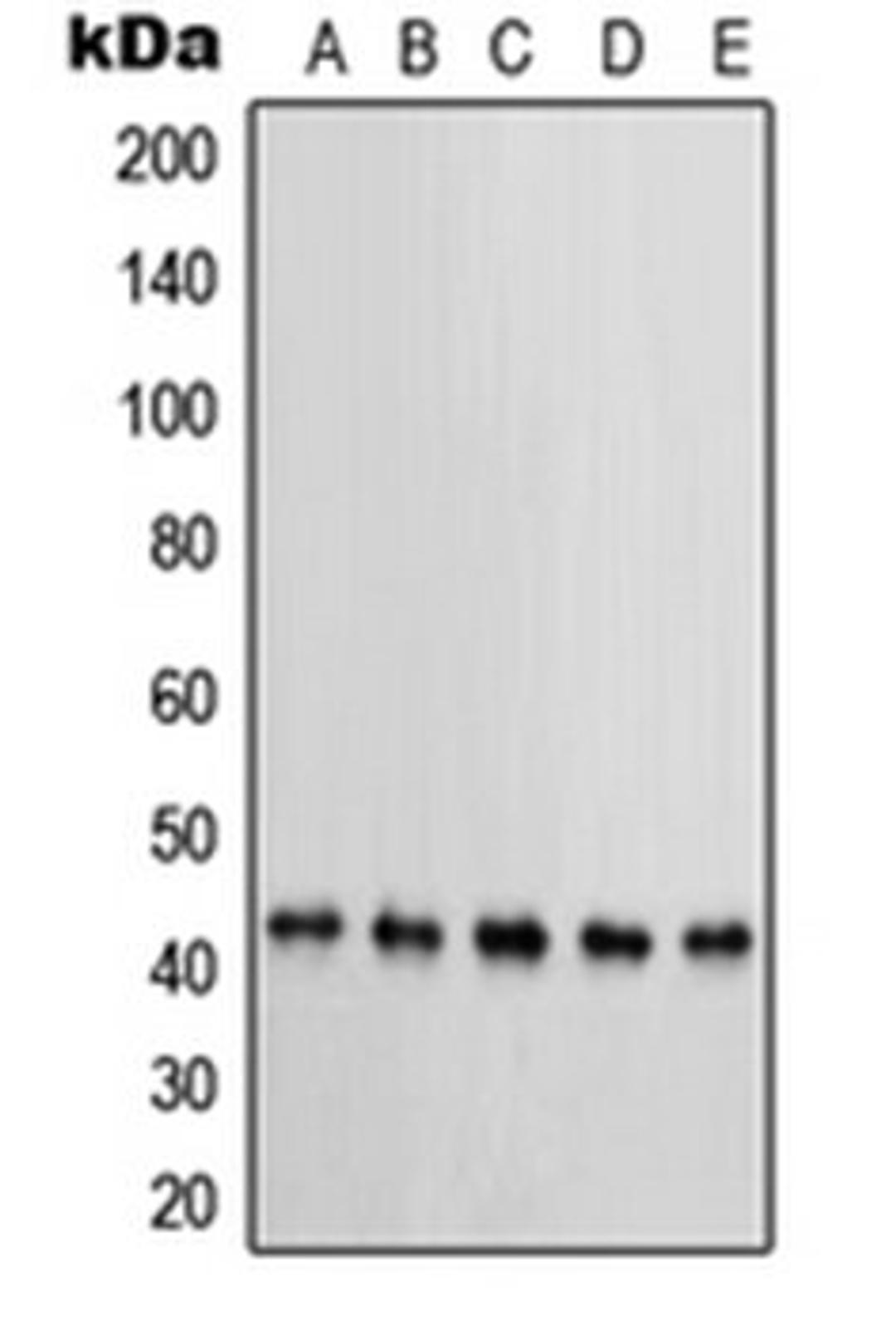 Western blot analysis of MCF7 (Lane 1), KNRK (Lane 2), NIH3T3 (Lane 3), HeLa (Lane 4), BT20 (Lane 5) whole cell lysates using PRKAR1B antibody