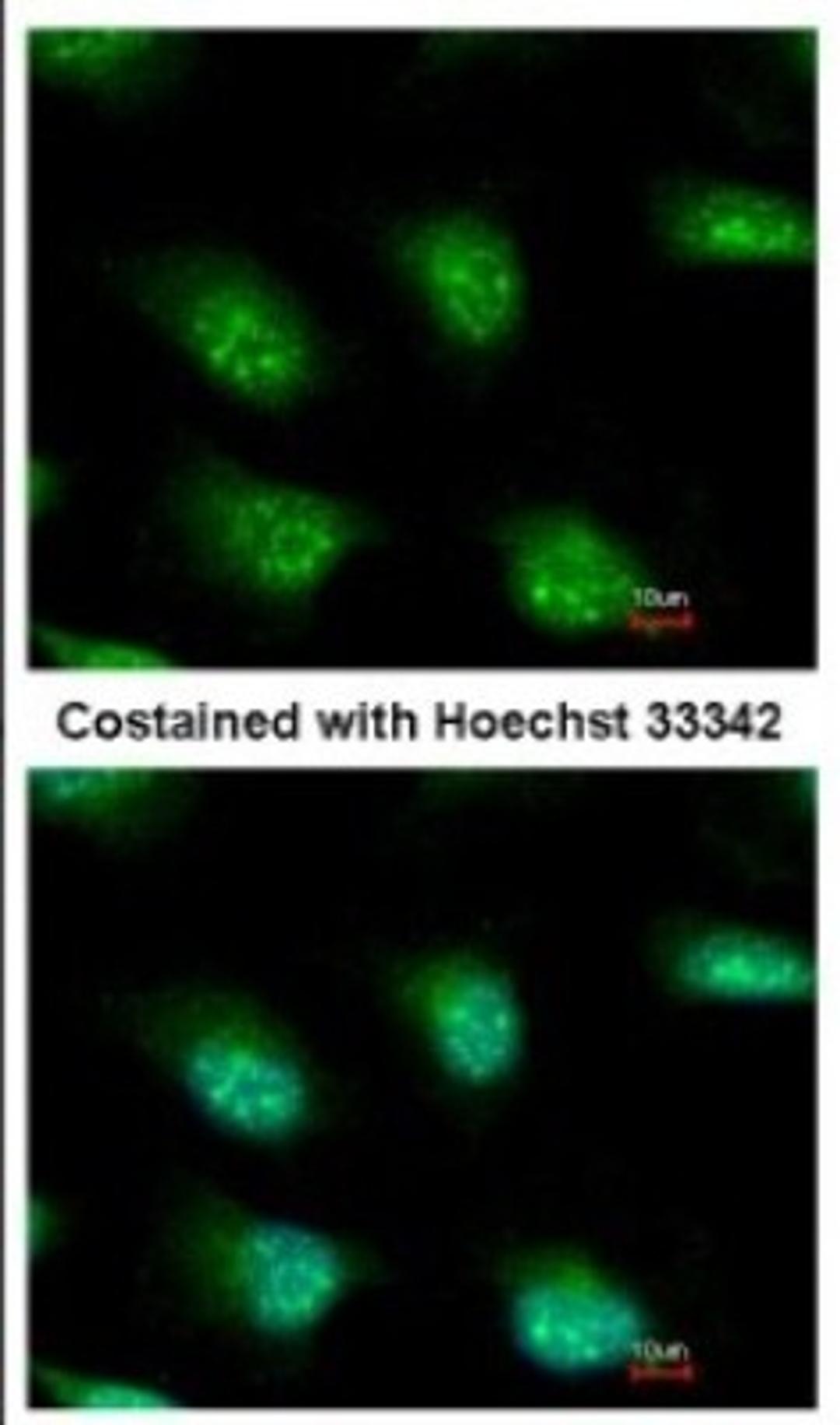 Immunocytochemistry/Immunofluorescence: KHNYN Antibody [NBP2-17041] - Immunofluorescence analysis of methanol-fixed HeLa, using antibody at 1:500 dilution.