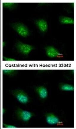 Immunocytochemistry/Immunofluorescence: KHNYN Antibody [NBP2-17041] - Immunofluorescence analysis of methanol-fixed HeLa, using antibody at 1:500 dilution.