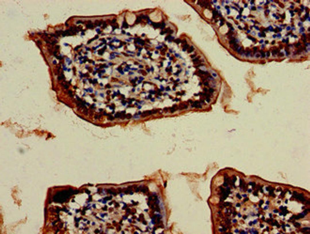 Immunohistochemistry of paraffin-embedded human small intestine tissue using CSB-PA025915LA01HU at dilution of 1:100
