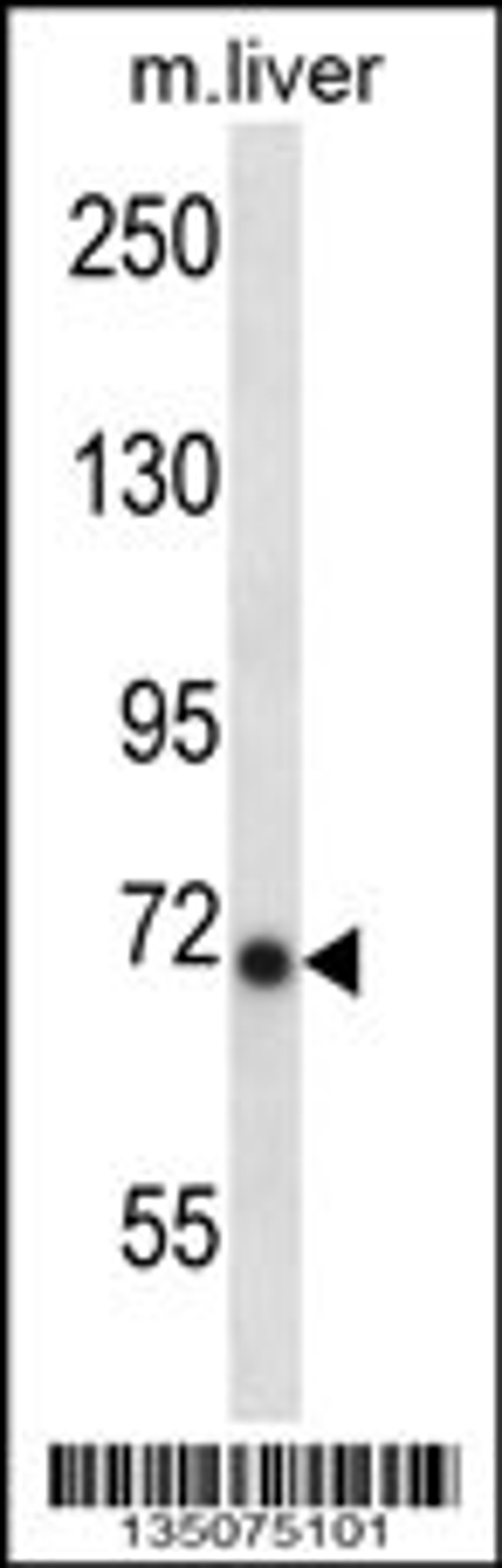 Western blot analysis in mouse liver tissue lysates (35ug/lane).