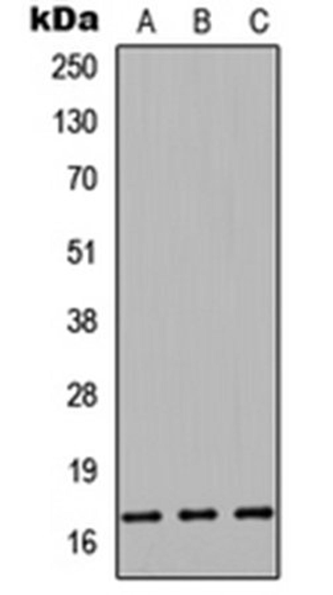 Western blot analysis of HEK293T (Lane1), Raw264.7 (Lane2), PC12 (Lane3) whole cell using Cystatin 9L antibody