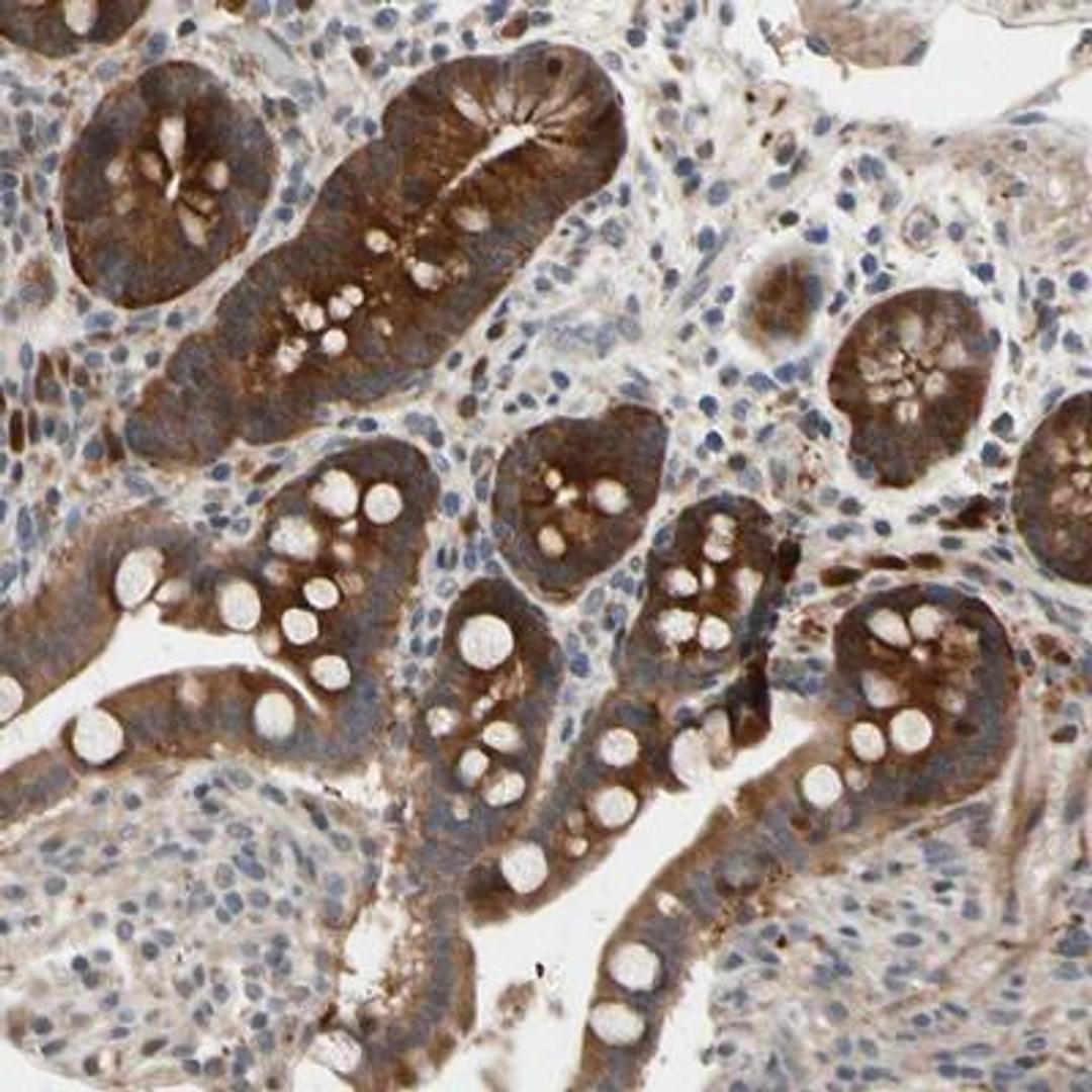 Immunohistochemistry: HMGCR Antibody [NBP1-91996] - Staining of human colon shows strong cytoplasmic positivity in glandular cells.