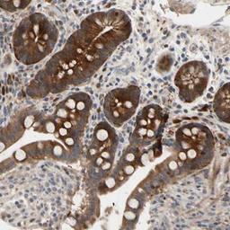 Immunohistochemistry: HMGCR Antibody [NBP1-91996] - Staining of human colon shows strong cytoplasmic positivity in glandular cells.