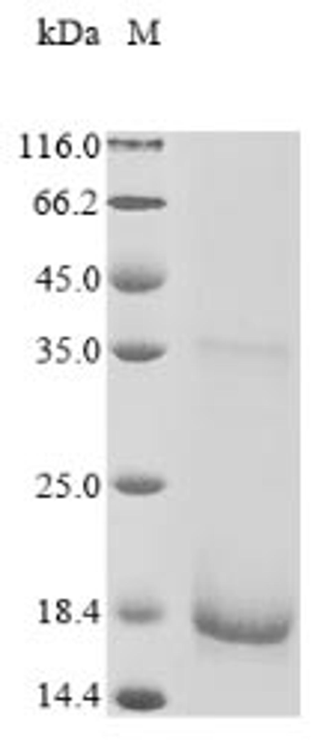 (Tris-Glycine gel) Discontinuous SDS-PAGE (reduced) with 5% enrichment gel and 15% separation gel.